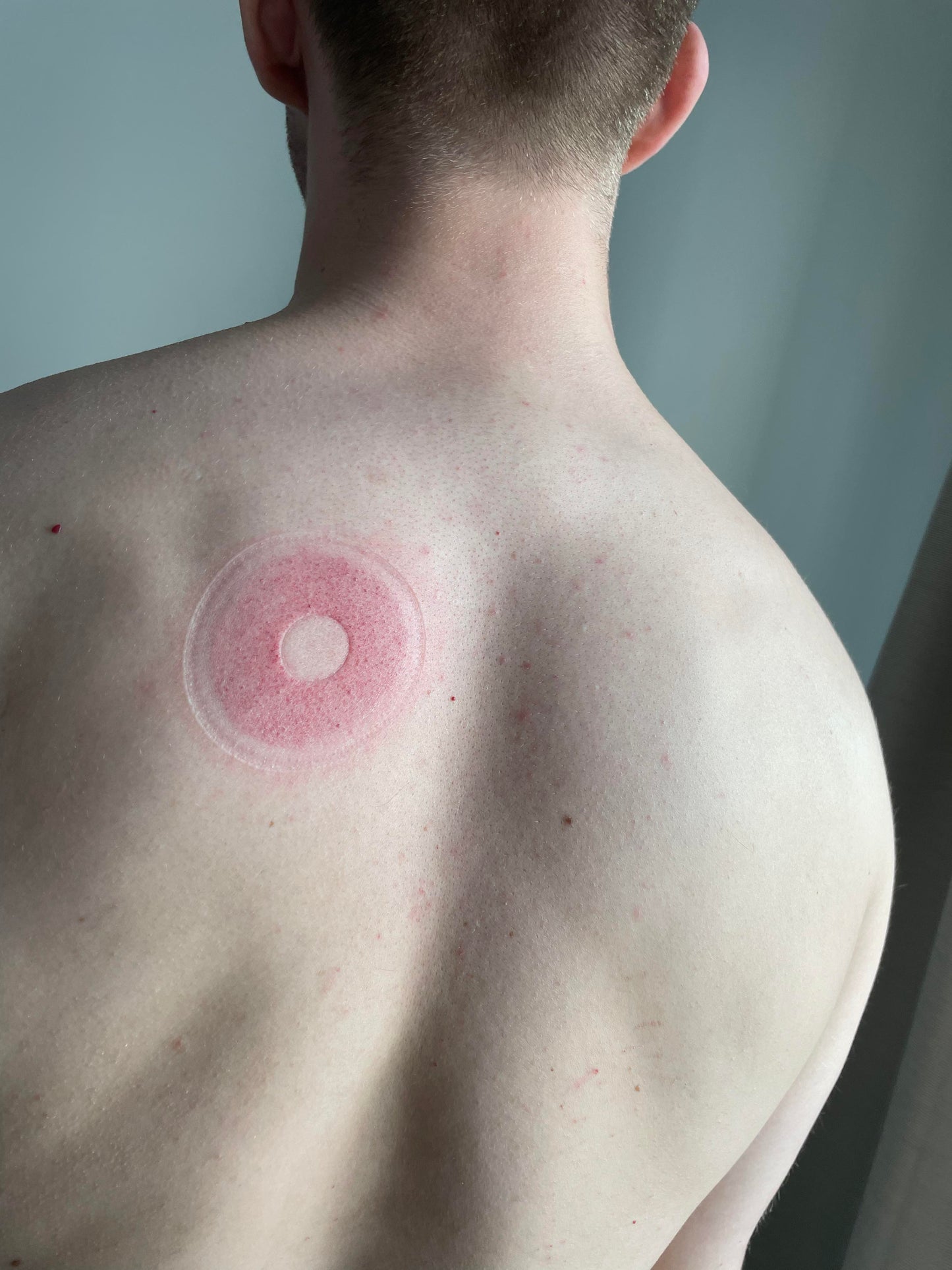 Smart Cupping Massager